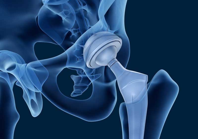 orthopaedics and traumatology interventional radiology and vascular surgery